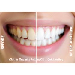 Pulling Oil Organic Herbal Mouthwash Teeth Whitener